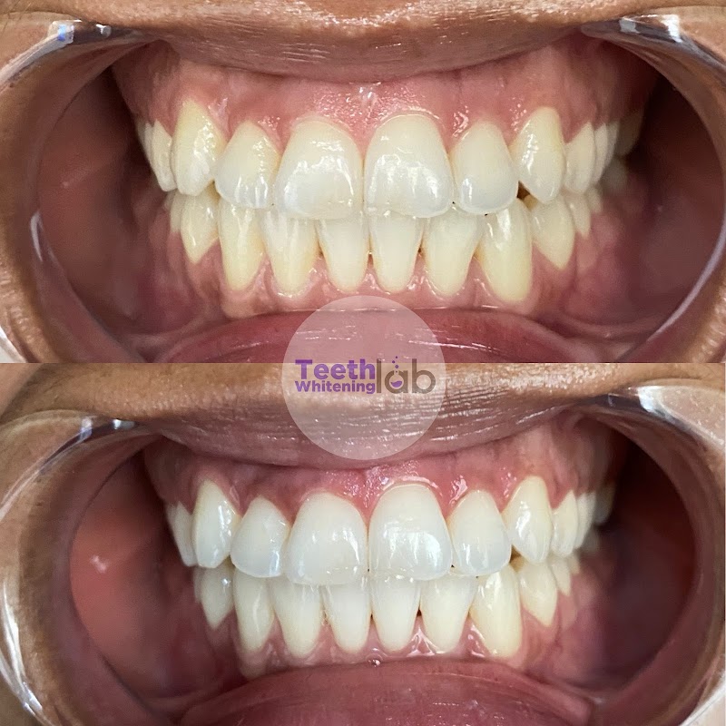 Teeth Whitening Lab Long Beach cover image