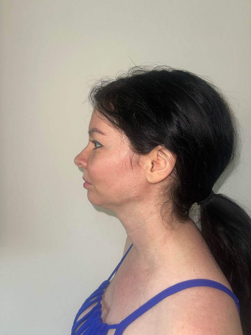 SN BEAUTY MEDICAL SPA cover image