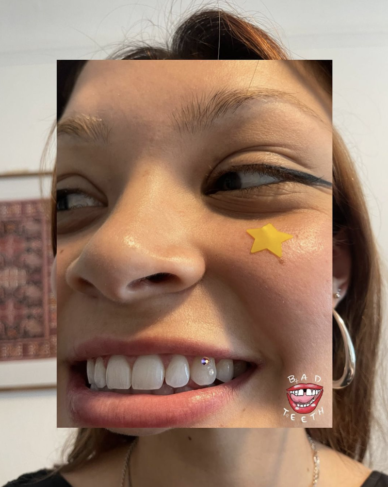 Bad Teeth Gems® Los Angeles Tooth Gems + Whitenings cover image