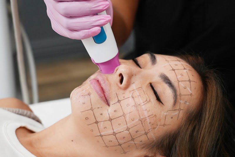 LaserAway Sacramento Fair Oaks cover image