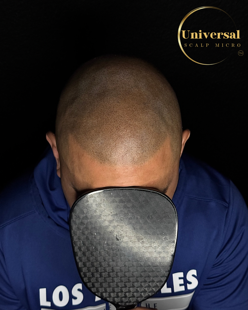 Universal Scalp Micro Pigmentation cover image