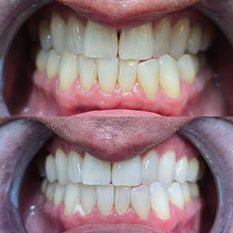 Gems Teeth Whitening cover image