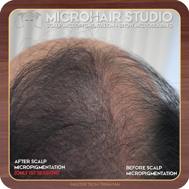 MicroHair Studio (Scalp Micropigmentation) cover image