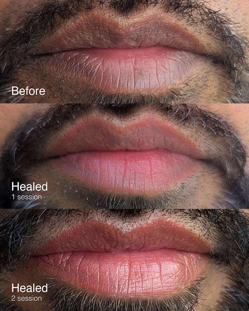 Blushed Beauty Lips⎮DFW Lip Blush, & Lip Neutralization cover image