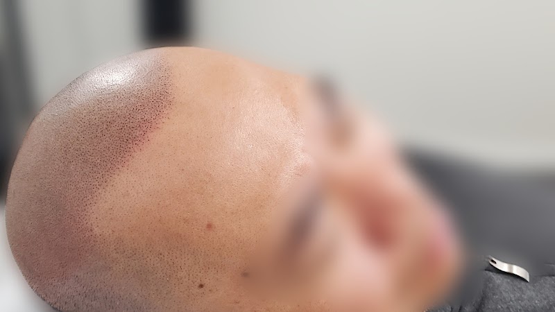 Downey Hair Loss Solutions SMP cover image