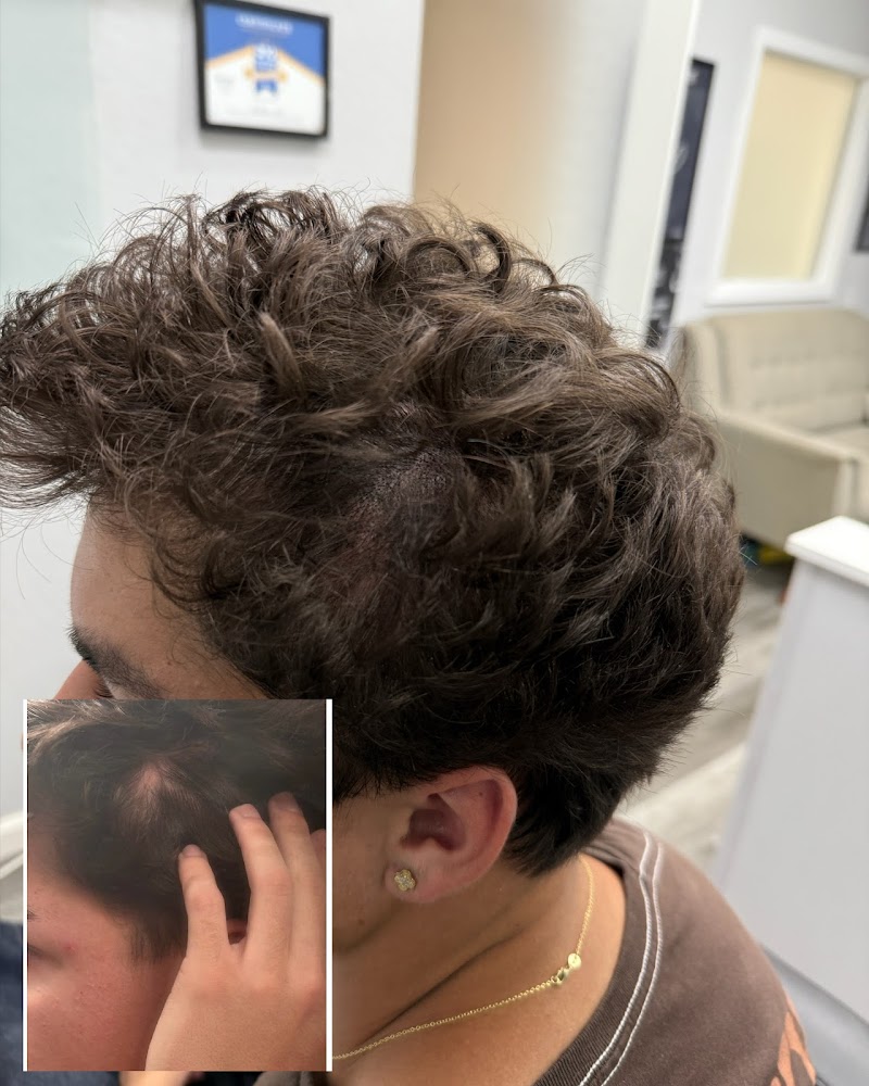 NuHair Ink Scalp Micro Pigmentation cover image