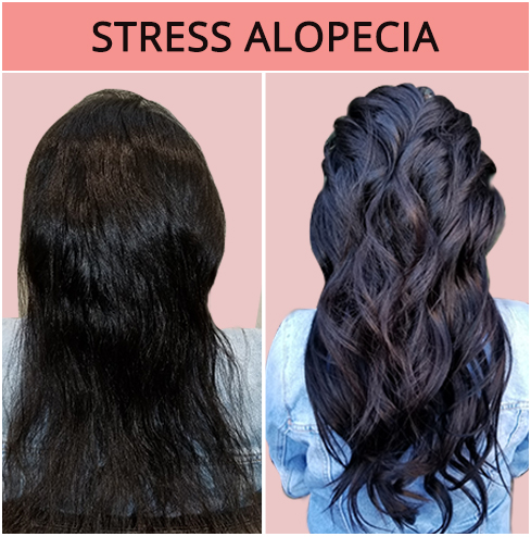 Bond Hair Bar - Hair Extensions Salon & Hair Loss Specialist cover image