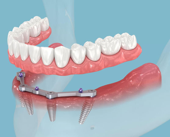 California Dental Group Los Angeles cover image