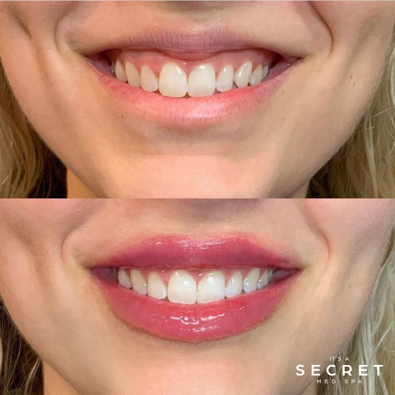 It's A Secret Med Spa - Austin cover image