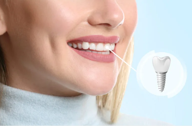 Elite Smile Dental PLLC cover