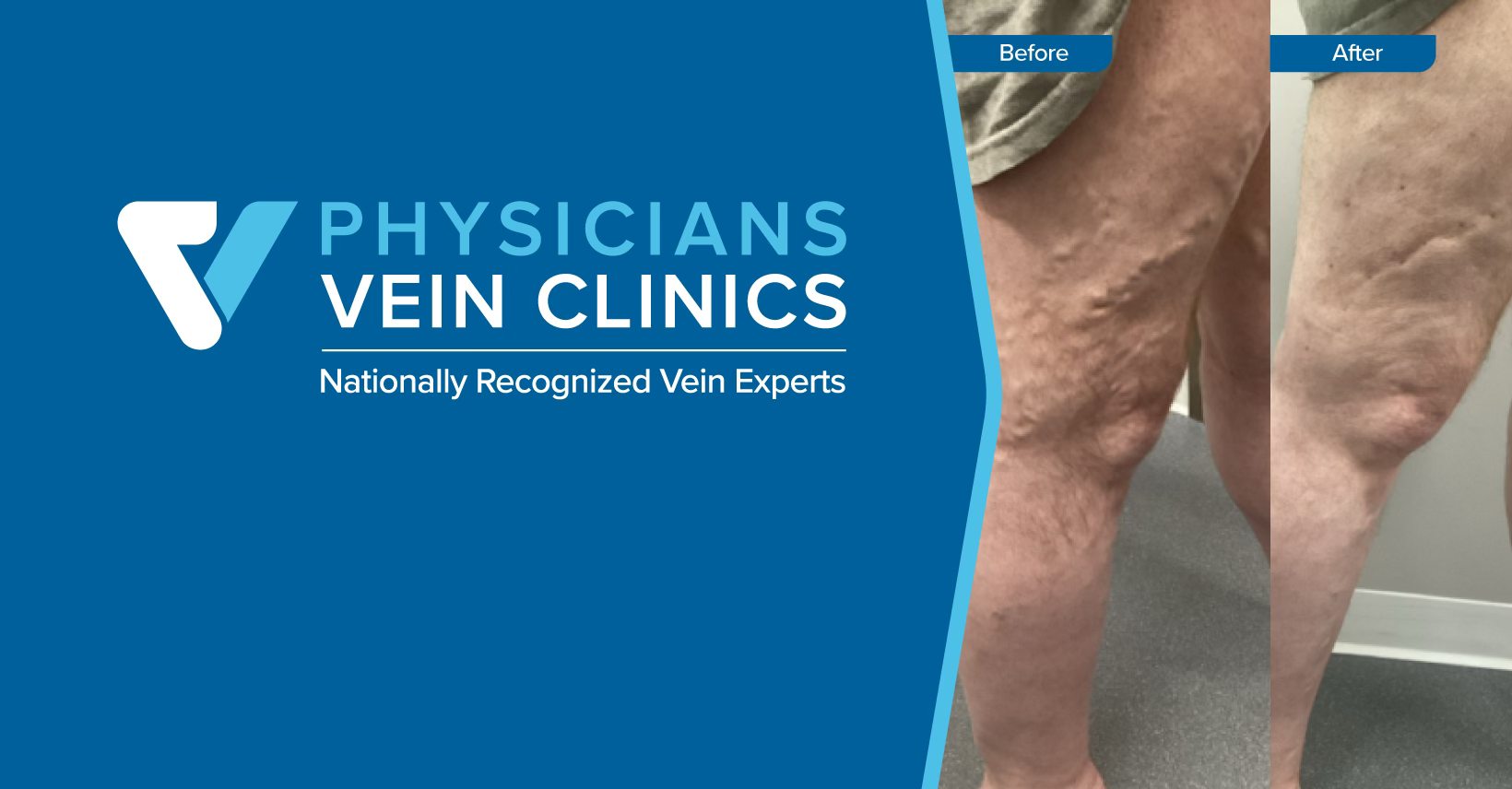 Physician Vein Clinics cover