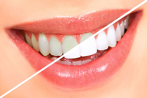 Purple Dental Care cover