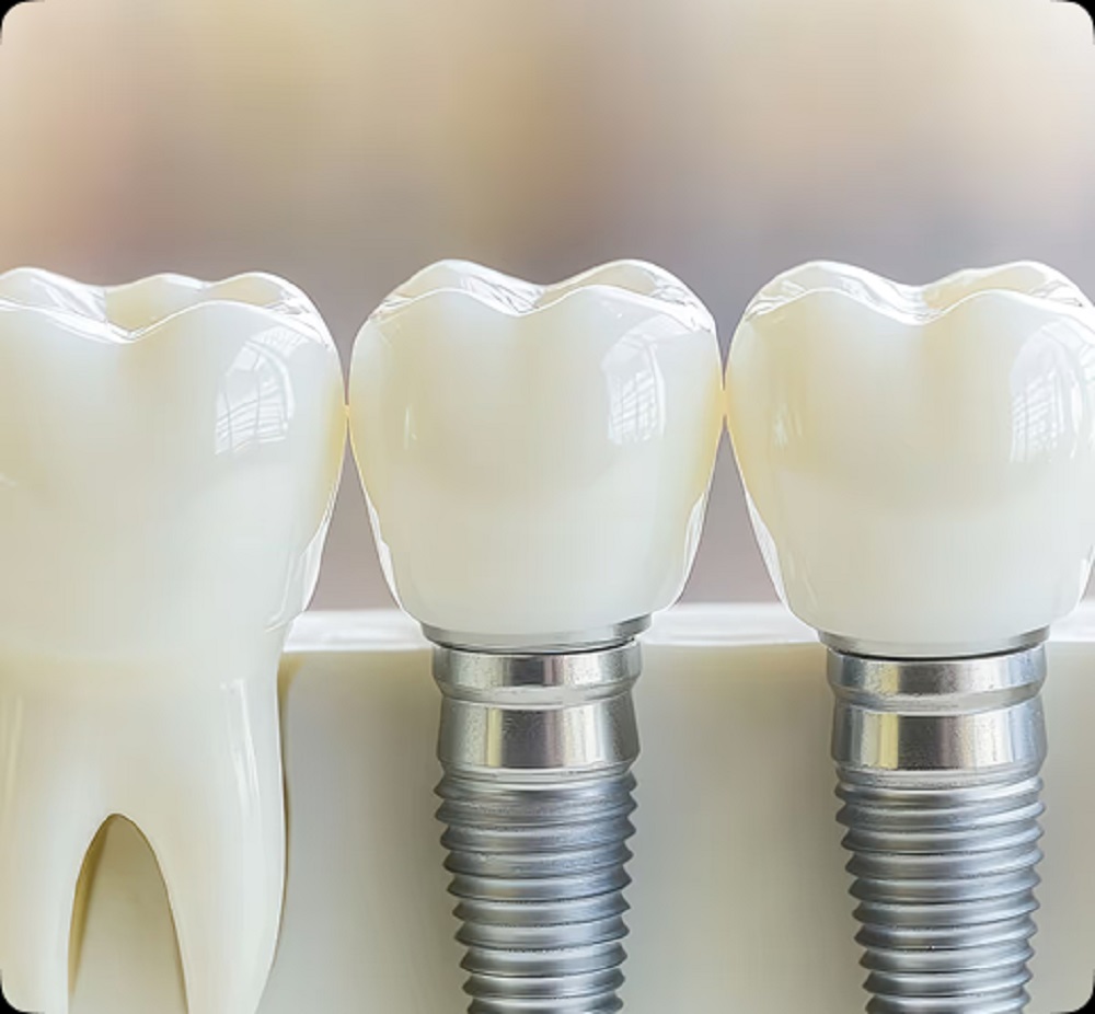 Pearly Smile Dental Studio - Shelby Township Dentist cover