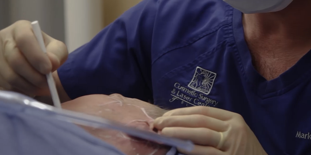 Cosmetic Surgery & Laser Center of El Paso cover